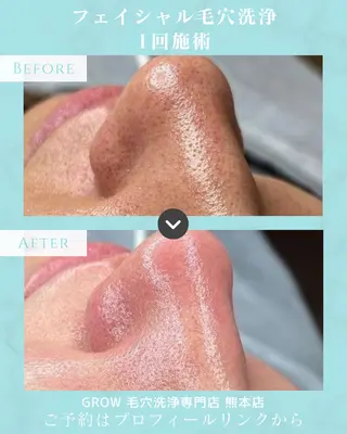 韓国式フェイシャル エステGROW熊本店のエステ・リラクイメージ