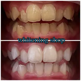 メンズ ホワイトニング ショップ川越店のエステ・リラクイメージ