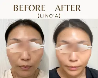 Salon💫 Lino'a柏店のエステ・リラクイメージ