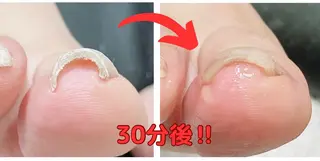 ネイル 深爪・巻き爪 専門サンセリテのネイルデザイン