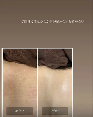 天使の艶肌　REVIハーブピーリング＆ヘッドスパ 武蔵小杉店所属・天使の 艶肌のエステ・リラクイメージ