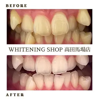 メンズ ホワイトニング ショップ高田馬場店のその他イメージ