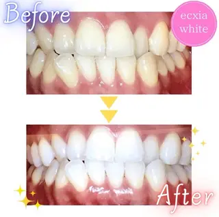 ホワイトニングサロンLuana-Sinfonia(エクシア)池袋店所属・セルフホワイトニング エクシア 池袋店のその他イメージ