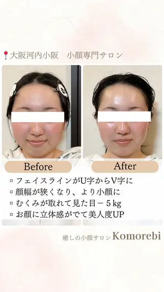 営業電話❌小顔サロン Komorebiのエステ・リラクイメージ
