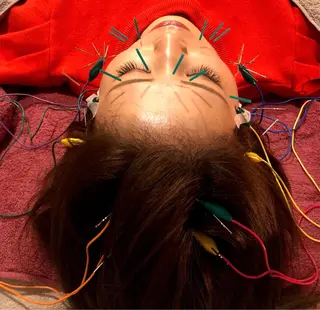 美容鍼サロン    Fleurir所属・伊藤 かなえのエステ・リラクイメージ