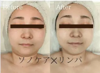 美肌脱毛＆小顔・フェ イシャル【SONA】のエステ・リラクイメージ