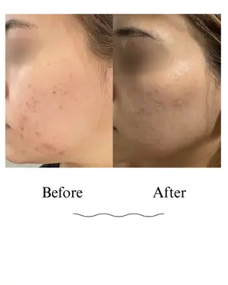 MAILE-マイレ-BEAUTY SALON所属・MAILE-マイレ- NARUMIのエステ・リラクイメージ