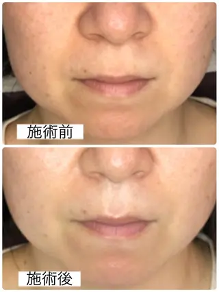 小顔・毛穴・たるみ ネイル　似内真樹のエステ・リラクイメージ