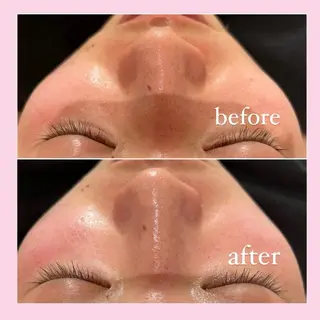 韓国肌管理専門店 White labo 宝塚店所属・有川 凜のエステ・リラクイメージ