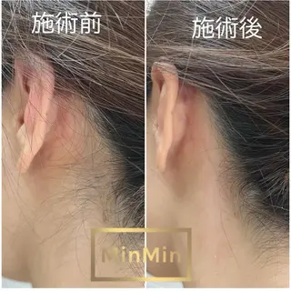 NoANoA Naguraの眉毛・アイブロウイメージ