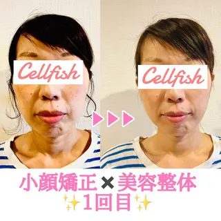 Cellfish ～セルフィッシュ～のエステ・リラクイメージ