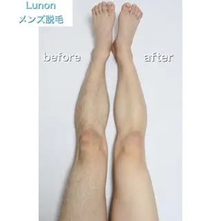 メンズ Lunon 【ルノン】のエステ・リラクイメージ