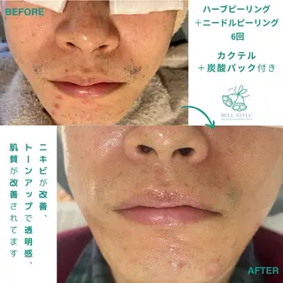 メンズ キッズ メンズ&レディース　Bell style所属・【脱毛・美肌専門】 bellstyleのエステ・リラクイメージ
