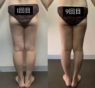 ハイパーナイフ専門店 Salon de COCO所属・Salon de COCOのエステ・リラクイメージ