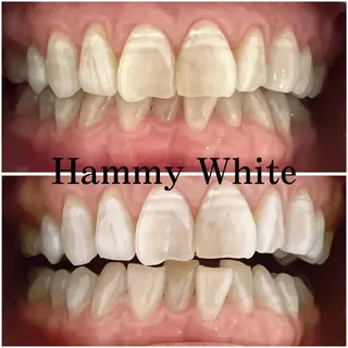 HammyWhite 心斎橋🌈AMIのその他イメージ