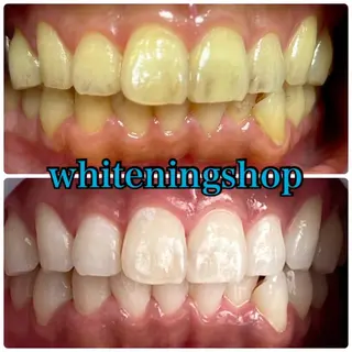 ホワイトニング ショップ吉祥寺店のエステ・リラクイメージ