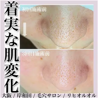 毛穴汚れ改善専門店/ 岸和田/リヒオルオルのエステ・リラクイメージ