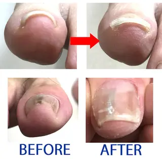 ネイル イワサキ  のネイルデザイン