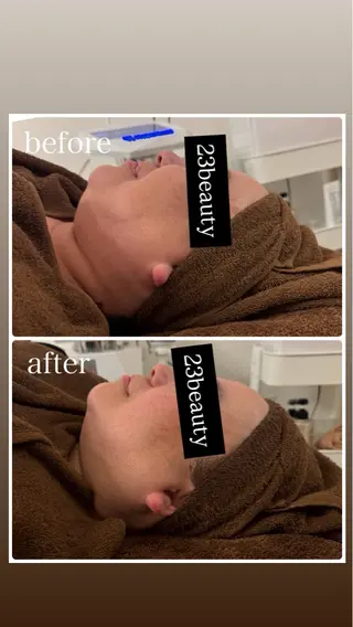 23beauty所属・武藤 那月のエステ・リラクイメージ