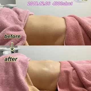 フェミニンエステ ティック大阪福島店のエステ・リラクイメージ