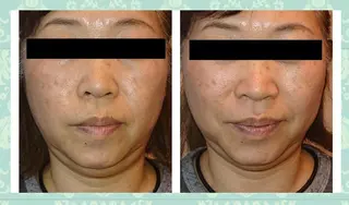 足圧リンパ整体 コグマのエステ・リラクイメージ