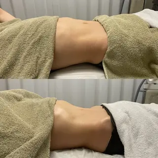 腸もみ・メンズ脱毛・ 毛穴洗浄〜カナロア〜のエステ・リラクイメージ