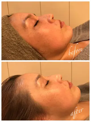 小顔×肌質改善サロン soin〔ソワン〕のエステ・リラクイメージ