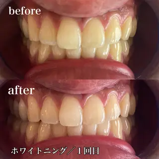 磐田｜LAYLA 一番丁寧な脱毛店のエステ・リラクイメージ