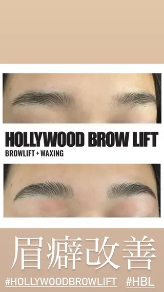 美容鍼灸整体サロンBeauJu所属・小顔矯/美容鍼/鍼灸 BeauJuのその他イメージ