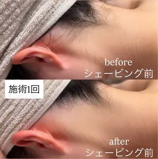 子供脱毛専門サロンReme【リミー】所属・添田 彩葉のエステ・リラクイメージ