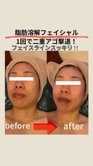 エステサロン グラマラスのエステ・リラクイメージ