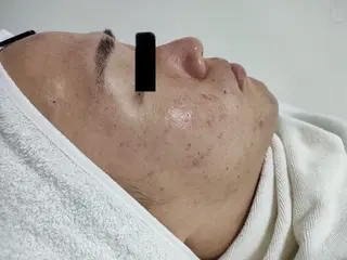 麻布十番エステサロン WhiteAzabuのエステ・リラクイメージ