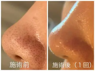 【都度払い脱毛 美肌脱毛】馬車道店のエステ・リラクイメージ