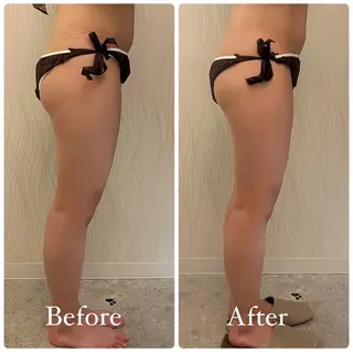 次世代痩身 人生最後のダイエットのエステ・リラクイメージ