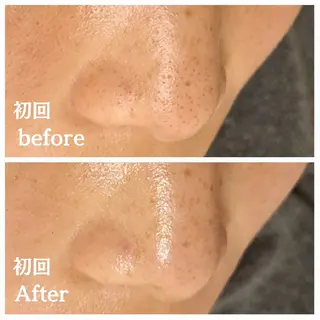 フェイシャル専門サロ ン　ERINのエステ・リラクイメージ