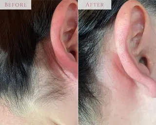 肌質改善専門サロン Bellmi/心斎橋のエステ・リラクイメージ