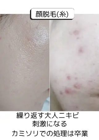 【糸脱毛×ドライヘッドスパ×お肌】salon LUOLA所属・salon LUOLAのヘアスタイル