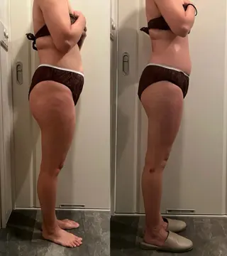 痩身/リラク 🎀KOZUKAのエステ・リラクイメージ