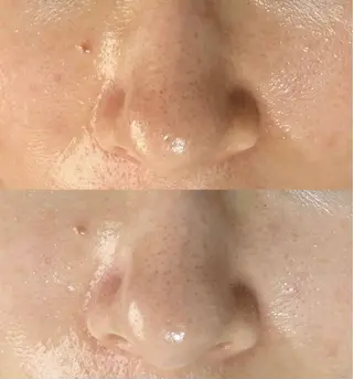 脱毛和みサロン新茶屋所属・脱毛和みサロン新茶屋 ひろみ（女性専用）のエステ・リラクイメージ