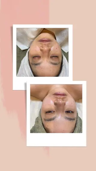 脱毛｜ピーリング ROOM.Sのエステ・リラクイメージ