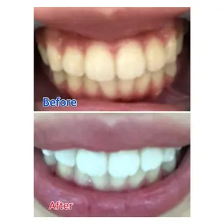 MBEAUTYSALON 千葉店・京成大久保所属・Melty 輝のその他イメージ