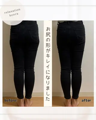 小顔矯正& 慢性肩こり腰痛改善店のエステ・リラクイメージ