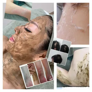 【剥離ありハーブピーリング専門エステ】cerisier BEAUTÉ 原宿所属・cerisier BEAUTÉのエステ・リラクイメージ