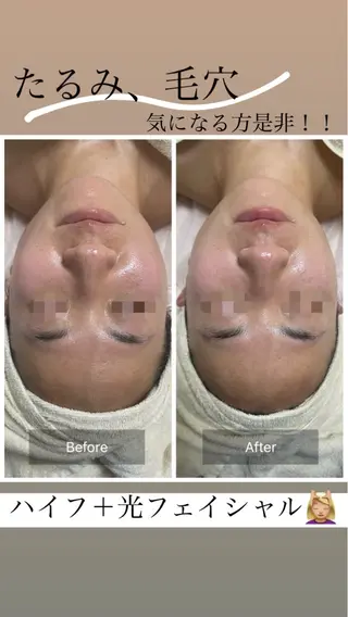 Private Beauty Salon " MEILI"所属・meili salonのエステ・リラクイメージ