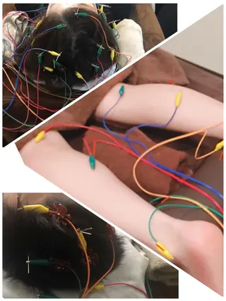 表参道鍼灸院K 美容鍼🔮ララピールのエステ・リラクイメージ