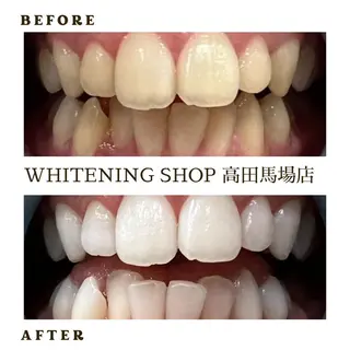 メンズ ホワイトニング ショップ高田馬場店のその他イメージ