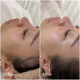 美肌育成専門サロンラクシュミー所属・毛穴肌管理サロン ラクシュミーのエステ・リラクイメージ