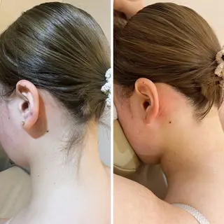 うなじ脱毛/美肌脱毛 LABELのエステ・リラクイメージ