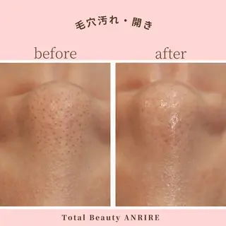 ANRIRE (アンリール)のエステ・リラクイメージ