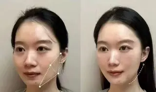 マツエク・マツパ aliaハイフ&水光ジェットサロン所属・aliaハーブ水光店 エステティシャン募集のエステ・リラクイメージ